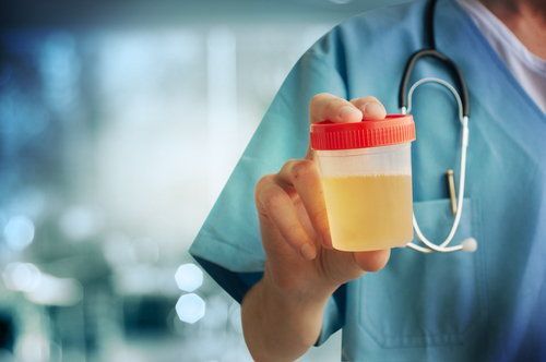 scientist holding urine sample container