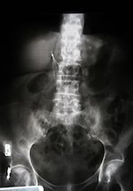 x-ray