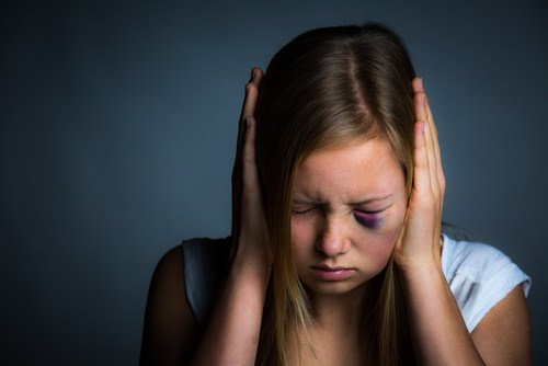 girl with black eye and hands over her ears