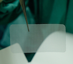 medical device