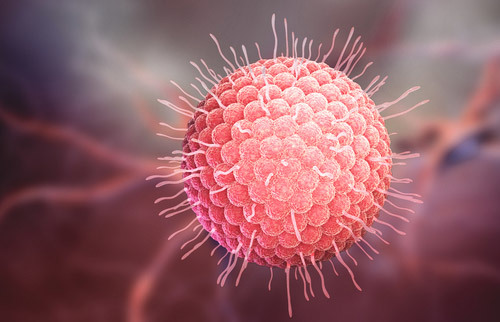 graphic representing herpes zoster