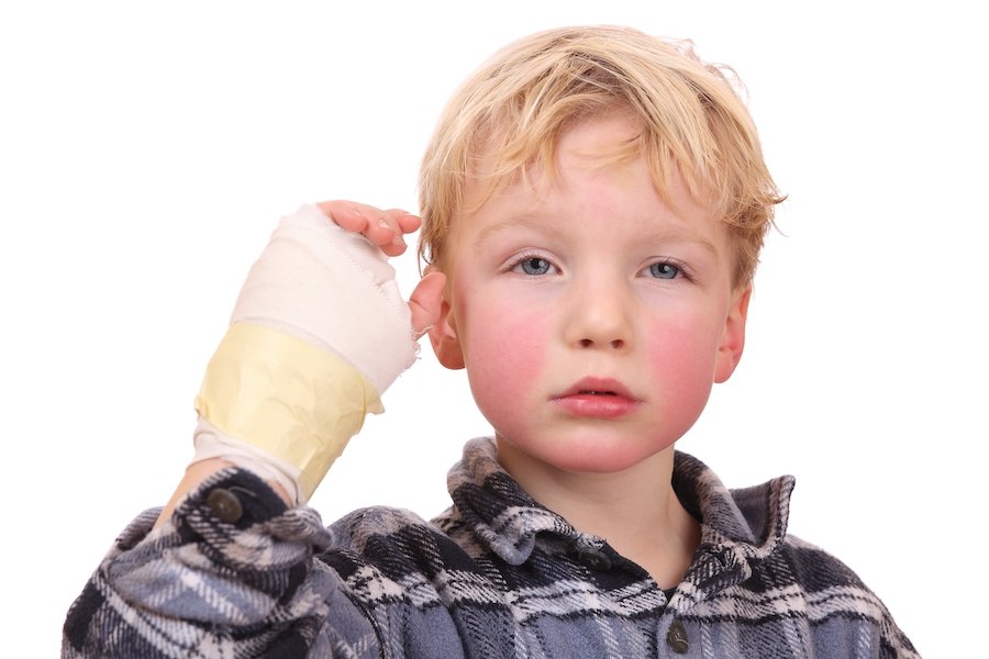 Child with a cast on his wrist