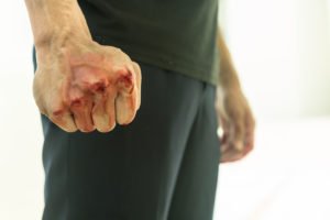 Hombre agresivo y violento en una pelea, con el puño ensangrentado.