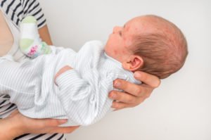 Newborn baby with forcepts bruises