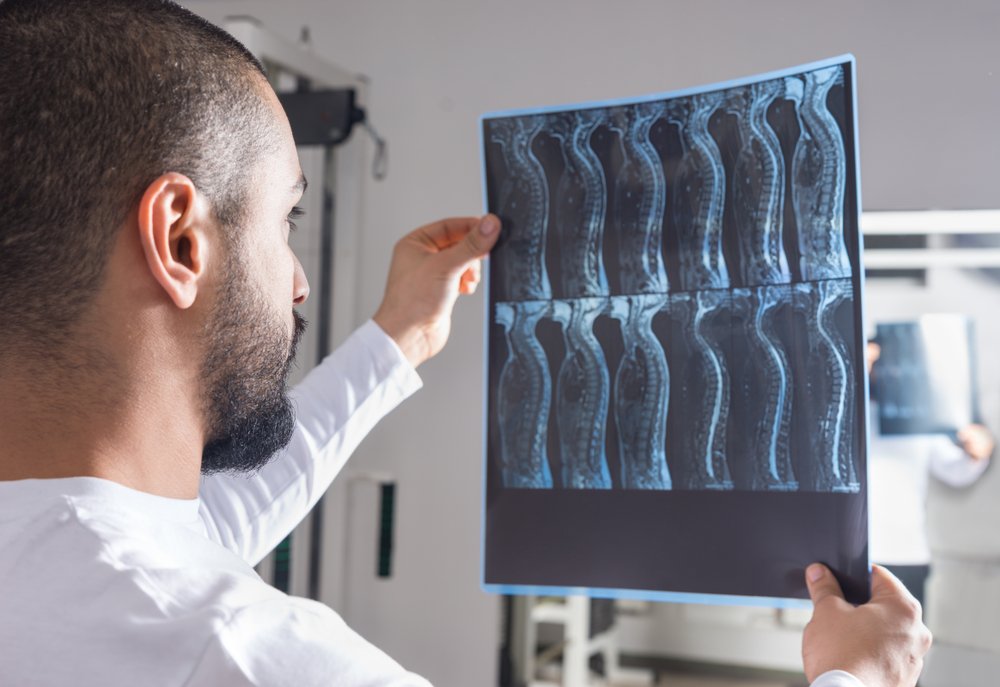 A radiologist looking over an Xray of a potentially damaged spinal cord..