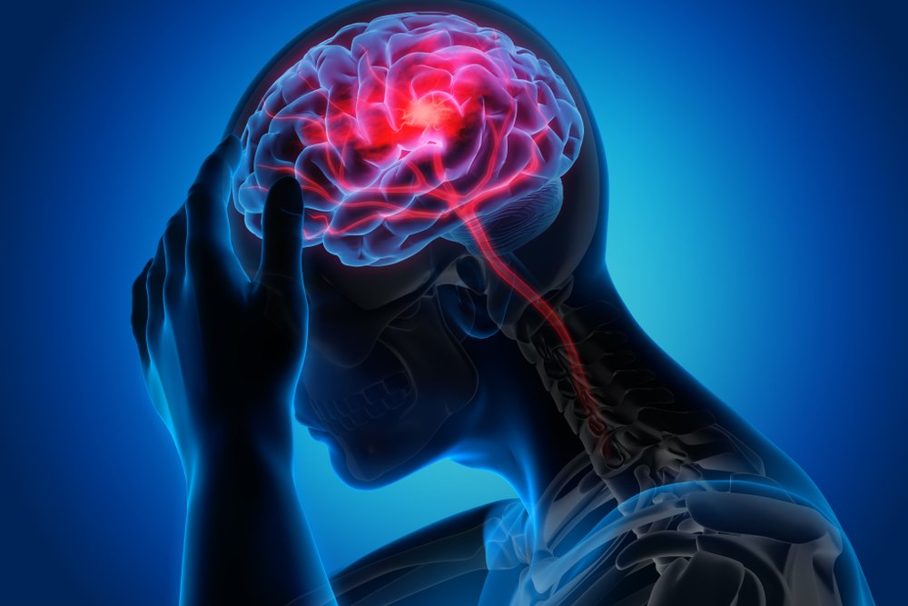 A CGI image of a person experiencing a brain injury.