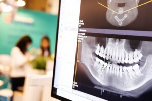 Screen showing dental xrays of Suboxone patient